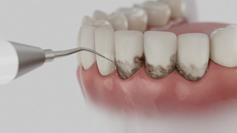 Trusted Root Canal Treatment service in Anderson, SC - Dentist Open Now